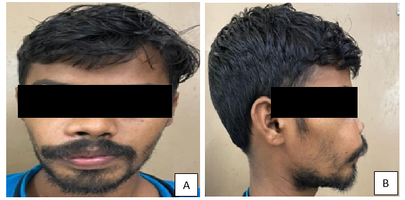 Extra oral appearance of the patient