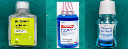 Groups and Type of Intervention. A. Group I -Probiotic mouthwash B. Group II Fluoridated mouthwash C. Group III Chlorhexidine mouthwash