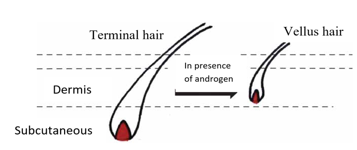 Characteristic of AGA.