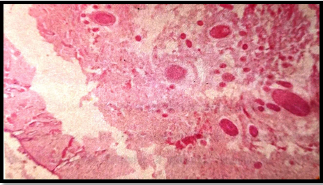 Photomicrograph of alopecia induced skin of rat