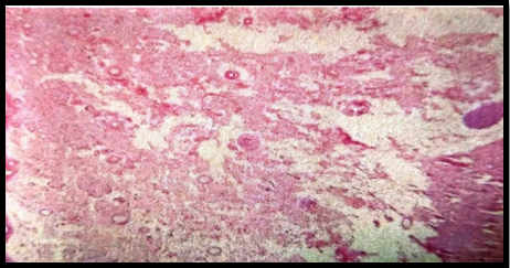 Photomicrograph of rat skin treated with standard drug(Minoxidil) 