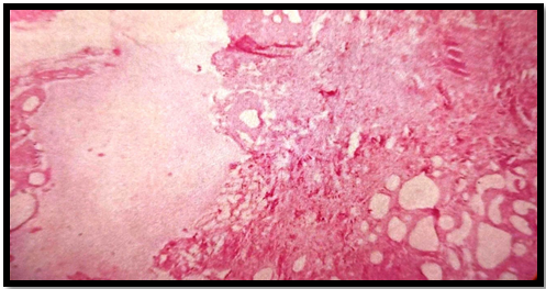 Photomicrograph of rat skin treated with betulin 10mg/kg p.o.