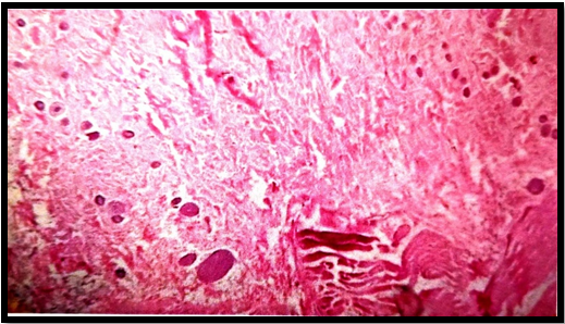 Photomicrograph of rat skin treated with Betulin 20mg/kg p.o.