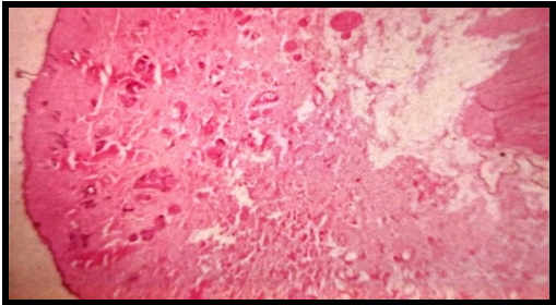 Photomicrograph of rat skin treated with Betulin 40mg/kg p.o.