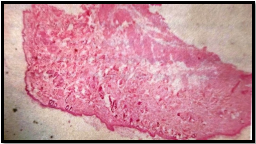 Photomicrograph of rat skin treated with Betulin topical solution