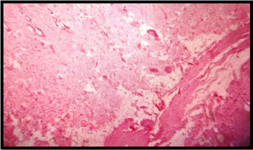 Photomicrograph of rat skin treated with combination of test and standard drug