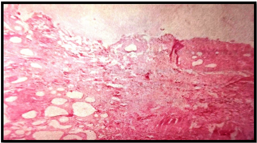 Photomicrograph of normal skin of rat