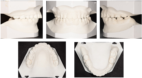 Post-treatment models