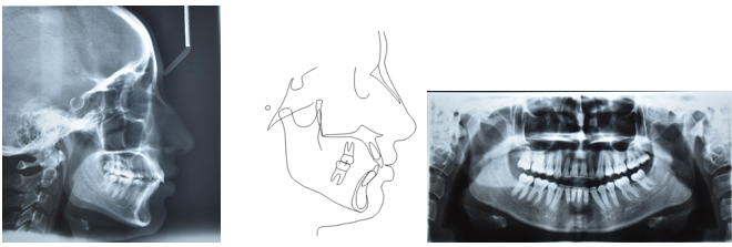 Post-treatment radiographs