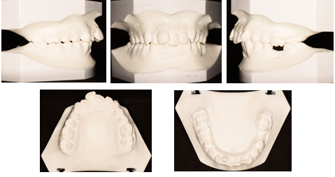 Pre-treatment models