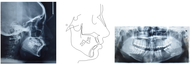 Pre-treatment radiographs