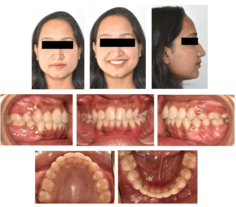 Post-treatment extraoral and intraoral records.