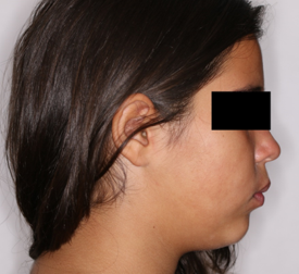 Initial profile photograph