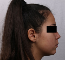 Final profile photograph