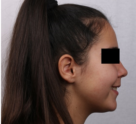 Final profile photograph with a smile