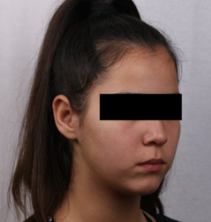 Final 3/4 profile photograph