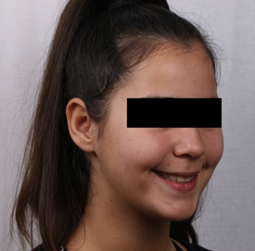 Final 3/4 profile photograph with a smile