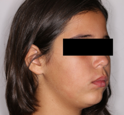 Initial 3/4 profile photograph