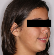 Initial 3/4 profile photograph with a smile