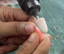 Trimming and finishing of samples