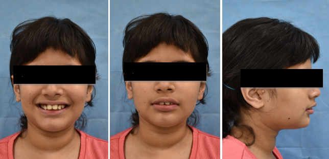 Extra-oral photographs