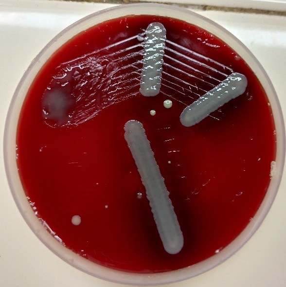 Blood agar plate showing growth after 48 hours of incubation