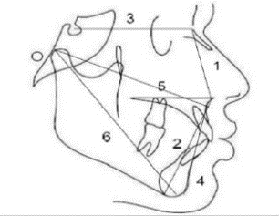 Linear parameters 1. N-ANS: Nasion to Anterior nasal spine 2. ANS –Me: Anterior nasal spine to Menton 3. S-N: Sella to Nasion 4. A-Pog: Point A to Pgo 5. Co- pt.A: Condylion to point A 6. Co-Gn: Condylion to Gnathion