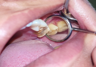Follow up after 15 days