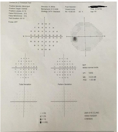 Visual fields-normal