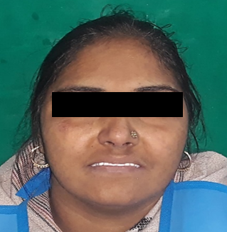 Denture insertion