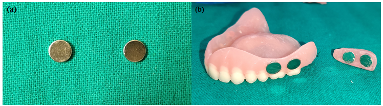 (a) Neodymium–iron–boron intra oral magnets (Nd–Fe–B); (b) Magnets sealed with autopolymerising acrylic resin