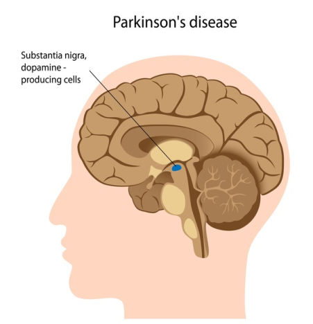 Substantia Nigra and Dopamine producing cells