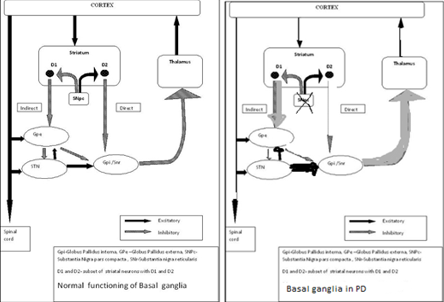 a. Function of BG in a normal-subject b. Function of BG in an abnormal (PD) subject