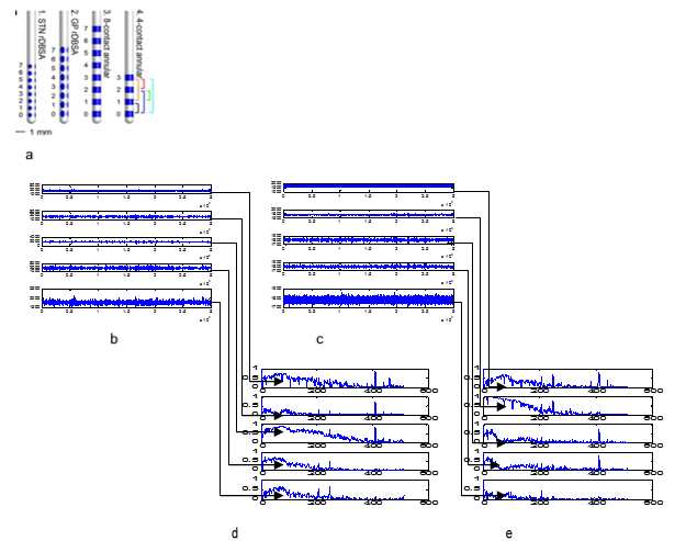 LFPs during STN recording: (a). DBS Leads, (b, c). LFP waveforms. Corresponding spectral densities (the PSDs) are shown in (d, e) highlights the computation of variability in the spectral peak. The frequency resolution of the spectral analysis signals was 0.95Hz, and coherence is considered to be highly significant if it is exceeded the degree of confidence level 93%.