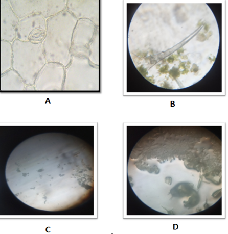 Powder characters of Lantana camara A: Stomata B: Trichome C: Calcium oxalate crystals D: Spiral vessels