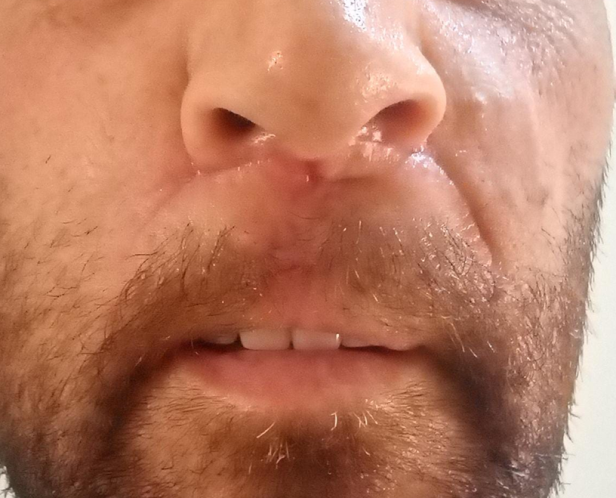 Routine follow-up examination after 2 weeks