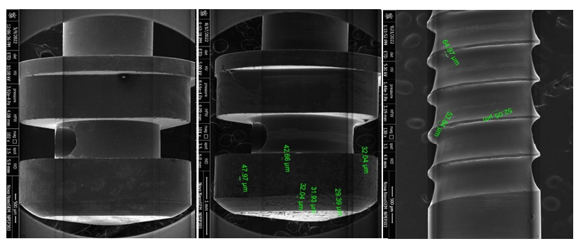 Images showing corrosion of implants