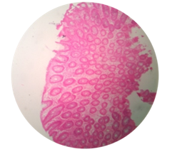 Photomicrograph of chronicnon-specific colitis H&EX10