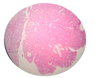 Photomicrograph of Tubular adenoma H&EX10 X