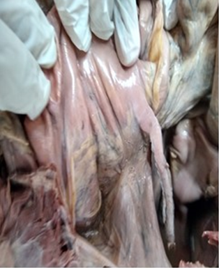 Showing pelvic appendix