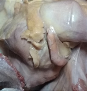 Showing postileal appendix