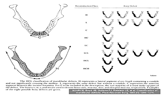 HCL classification