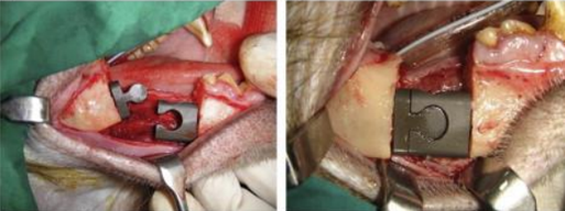 Mandibular segmental reconstruction using a bioactive-coated cementless Ti6Al4V modular endoprosthesis which was inserted in the segmental defect of aMacaca fascicularis monkey