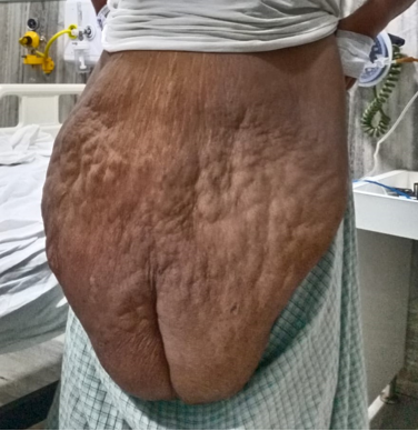 Photo before surgery