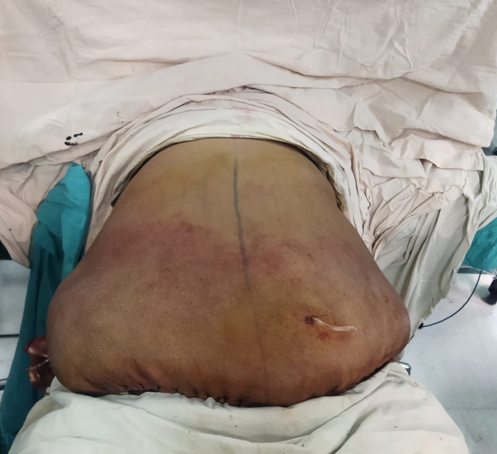 Photo after surgery