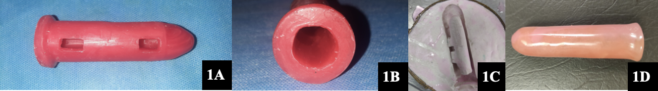 Fabrication of hollow vaginal stent; A: Vaginal stent Wax pattern with two windows; B: Base of the Vaginal stent Wax pattern with Hollowness; C: Mold of the vaginal stent with a hollow cavity, created in a conventional flask following the dewaxing process; D: Final prosthetic Vaginal stent (The base and windows after processing sealed with Self cure acrylic resin).