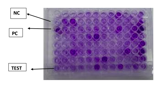Biofilm production by microtiter plate method