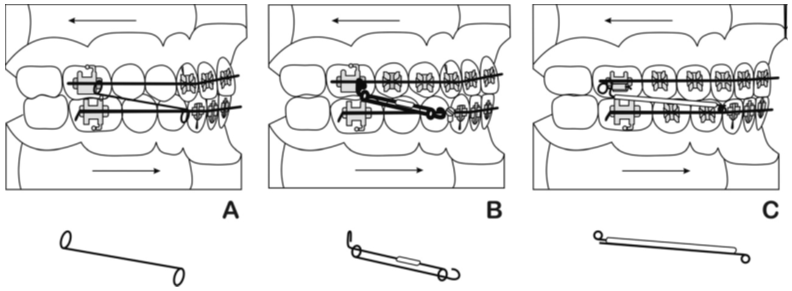 A, MPA I; B, MPA II; C, MPA III. 14