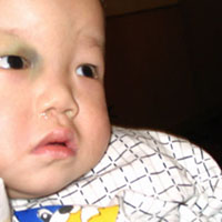 Yeah, but you should see the other baby.