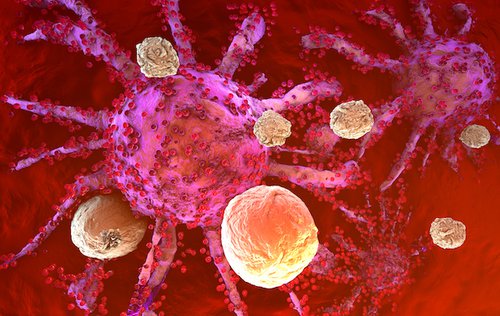 New Immunotherapy Can Prevent Kidney Cancer Recurrence After Surgery New Immunotherapy Can Prevent Kidney Cancer Recurrence After Surgery